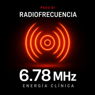 Radiofrecuencia
